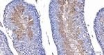 PGK1 Antibody in Immunohistochemistry (Paraffin) (IHC (P))