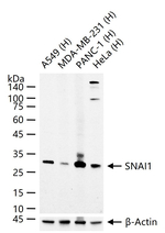 SNAIL Monoclonal Antibody (S1F6)