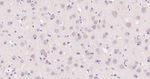 EZH2 Monoclonal Antibody (E3H5)