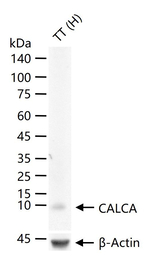 Calcitonin Monoclonal Antibody (G8D24)