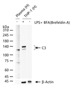 Complement C3 Monoclonal Antibody (B3N11)