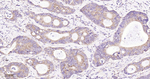 BCL-10 Antibody in Immunohistochemistry (Paraffin) (IHC (P))