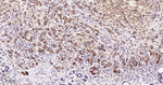BCL-10 Antibody in Immunohistochemistry (Paraffin) (IHC (P))