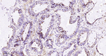 BCL-10 Antibody in Immunohistochemistry (Paraffin) (IHC (P))
