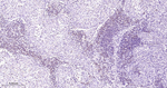 BCL-10 Monoclonal Antibody (G56)