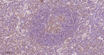 BCL-10 Antibody in Immunohistochemistry (Paraffin) (IHC (P))