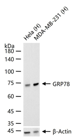 GRP78 Monoclonal Antibody (D12H2)
