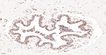 Lamin A/C Antibody in Immunohistochemistry (Paraffin) (IHC (P))