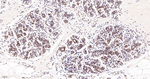 Lamin A/C Antibody in Immunohistochemistry (Paraffin) (IHC (P))