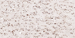 Calreticulin Antibody in Immunohistochemistry (Paraffin) (IHC (P))