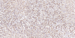 Calreticulin Antibody in Immunohistochemistry (Paraffin) (IHC (P))