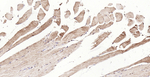 Calreticulin Antibody in Immunohistochemistry (Paraffin) (IHC (P))
