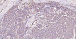 Calreticulin Antibody in Immunohistochemistry (Paraffin) (IHC (P))