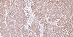 Calreticulin Antibody in Immunohistochemistry (Paraffin) (IHC (P))