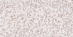 Calreticulin Antibody in Immunohistochemistry (Paraffin) (IHC (P))