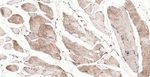 Calreticulin Antibody in Immunohistochemistry (Paraffin) (IHC (P))