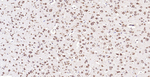 Calreticulin Antibody in Immunohistochemistry (Paraffin) (IHC (P))