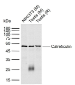 Calreticulin Antibody in Western Blot (WB)