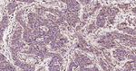 Aurora A Antibody in Immunohistochemistry (Paraffin) (IHC (P))