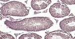 Aurora A Antibody in Immunohistochemistry (Paraffin) (IHC (P))