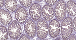 Aurora A Antibody in Immunohistochemistry (Paraffin) (IHC (P))