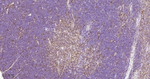 Aurora A Antibody in Immunohistochemistry (Paraffin) (IHC (P))