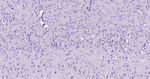 c-Kit Antibody in Immunohistochemistry (Paraffin) (IHC (P))