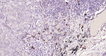 c-Kit Antibody in Immunohistochemistry (Paraffin) (IHC (P))