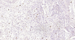c-Kit Antibody in Immunohistochemistry (Paraffin) (IHC (P))