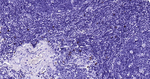 c-Kit Antibody in Immunohistochemistry (Paraffin) (IHC (P))