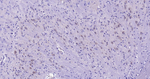 c-Kit Antibody in Immunohistochemistry (Paraffin) (IHC (P))