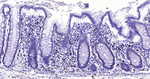 c-Kit Antibody in Immunohistochemistry (Paraffin) (IHC (P))