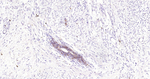 c-Kit Antibody in Immunohistochemistry (Paraffin) (IHC (P))