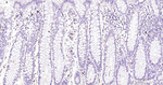c-Kit Antibody in Immunohistochemistry (Paraffin) (IHC (P))