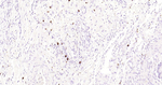 c-Kit Antibody in Immunohistochemistry (Paraffin) (IHC (P))