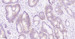 Claudin 1 Antibody in Immunohistochemistry (Paraffin) (IHC (P))