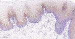 Claudin 1 Monoclonal Antibody (8G1)
