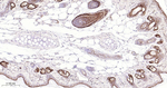 Claudin 1 Antibody in Immunohistochemistry (Paraffin) (IHC (P))