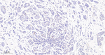 Cyclin E2 Antibody in Immunohistochemistry (Paraffin) (IHC (P))