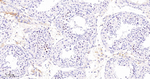 Cyclin E2 Antibody in Immunohistochemistry (Paraffin) (IHC (P))