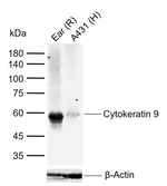 KRT9 Recombinant Rabbit Monoclonal Antibody (4F8)