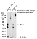 FosB Antibody in Western Blot (WB)