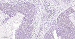 HIF-1 beta Antibody in Immunohistochemistry (Paraffin) (IHC (P))