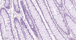HIF-1 beta Antibody in Immunohistochemistry (Paraffin) (IHC (P))