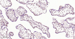 HIF-1 beta Antibody in Immunohistochemistry (Paraffin) (IHC (P))