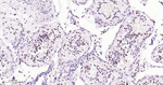 HIF-1 beta Antibody in Immunohistochemistry (Paraffin) (IHC (P))