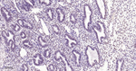 HIF-1 beta Antibody in Immunohistochemistry (Paraffin) (IHC (P))