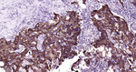 Phospho-EGFR (Ser695) Antibody in Immunohistochemistry (Paraffin) (IHC (P))