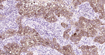 Phospho-EGFR (Ser695) Antibody in Immunohistochemistry (Paraffin) (IHC (P))