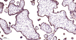 Phospho-EGFR (Ser695) Antibody in Immunohistochemistry (Paraffin) (IHC (P))